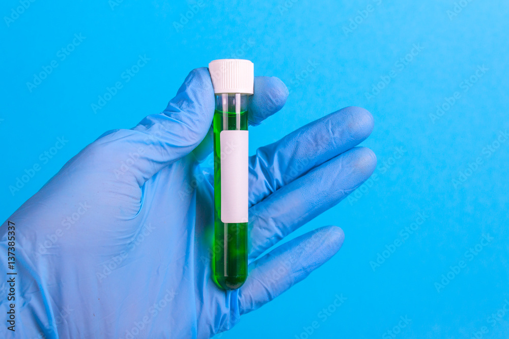 test tube with the virus in the hand with a glove test tube with the virus in the hand with a glove