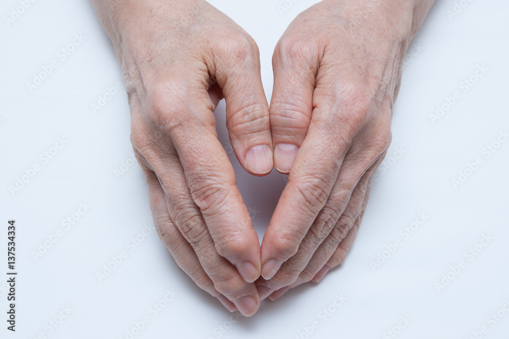 Fototapeta premium Osteoarthritis Hands and fingers of a female's hands.