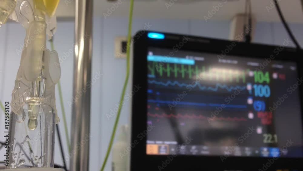 monitoring of vital functions during surgery
monitoring of vital functions during surgery