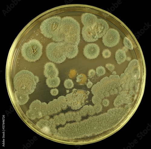 Colonies of  allergenic fungus from air spores on a petri dish (agar plate) manually isolated on a black background. Nutrient agar media  used.  Focus on full depth. photo