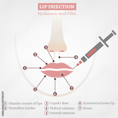 Lips Injections Image