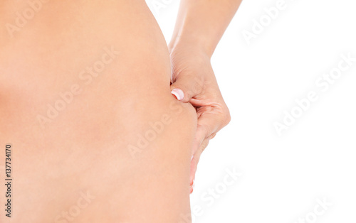 Slim woman pinch skin on hip