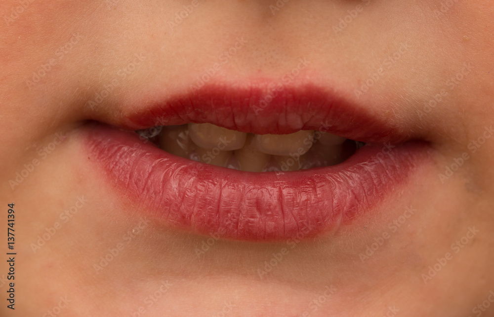 Obraz premium red chapped lips