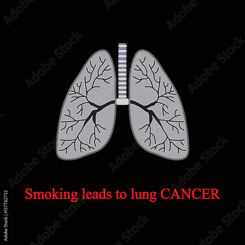 Smoking leads to lung cancer. Vector illustration on a black background