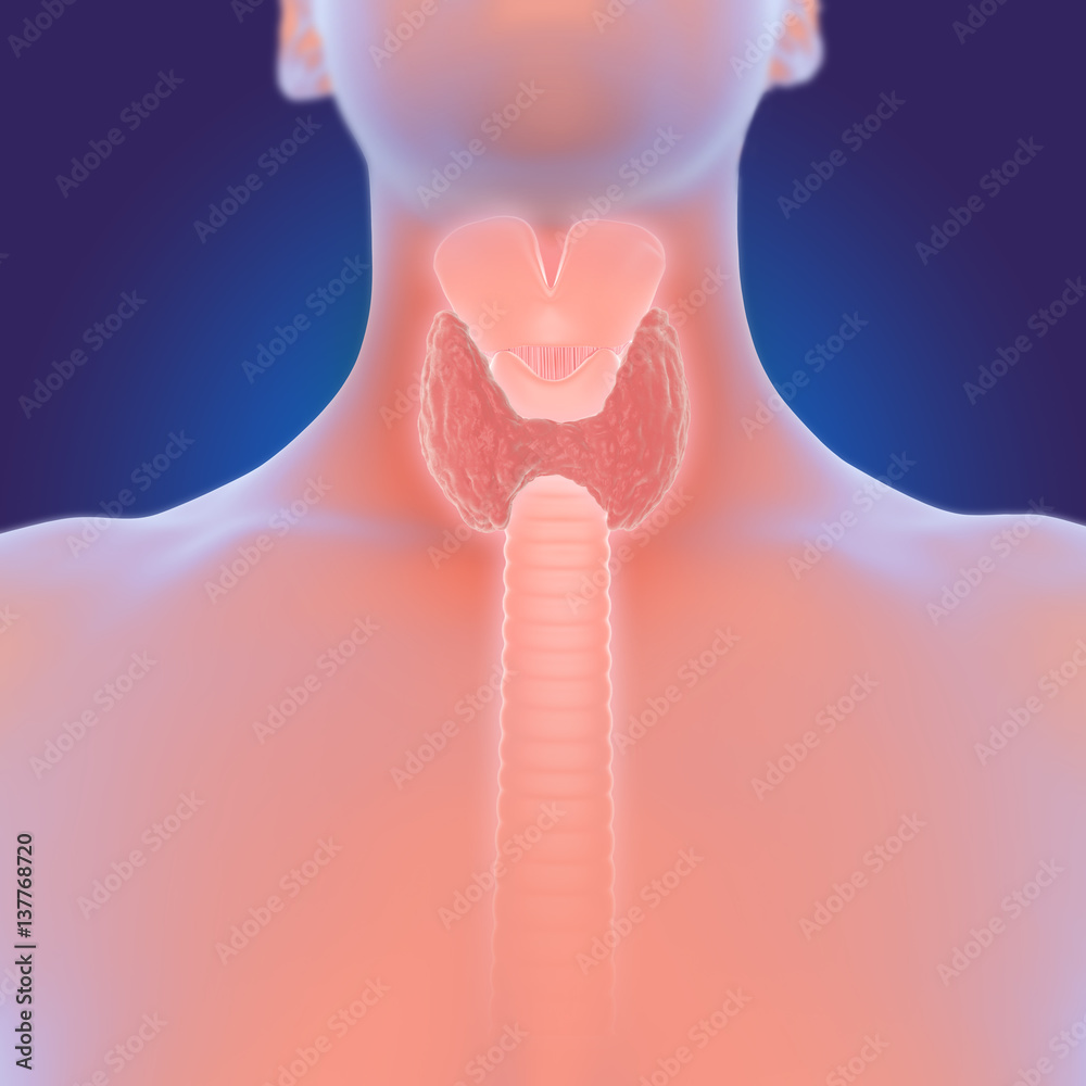 Struma Schilddrüsenvergrößerung StockIllustration Adobe Stock