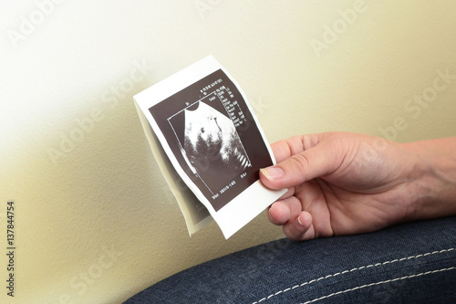 Pregnant woman with ultrasound picture. USG
