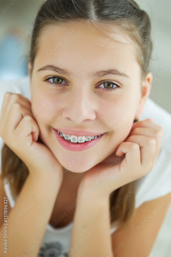 Girl with braces Girl with braces