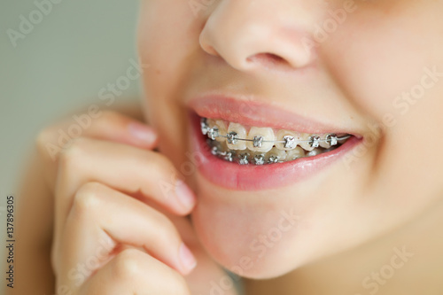 Girl with braces 