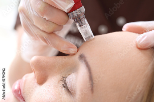 Kosmetyczka wykonuje zabieg mezoterapii igłowej na twarz kobiety