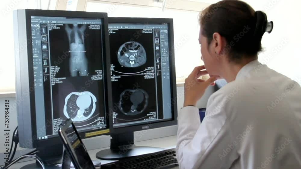 Young Woman Doctor Examines the Results of Patient Famale Breast Cancer Research on the Computer
