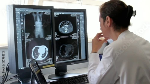 Young Woman Doctor Examines the Results of Patient Famale Breast Cancer Research on the Computer