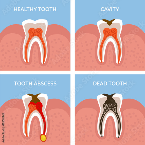 Teeth