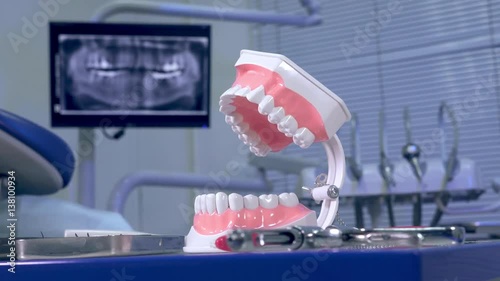 Tooth model against the backdrop of a panoramic X-ray at the dentist's office