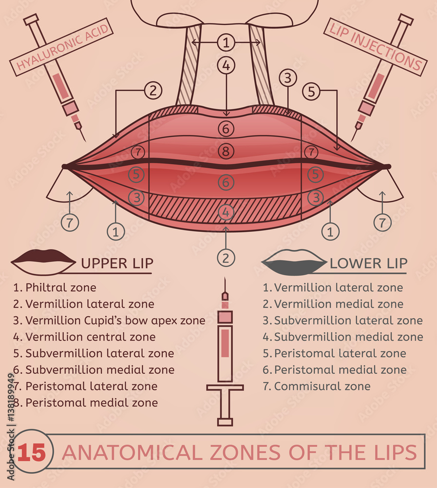 Lip Flip Injection Points Diagram Lip Flip Injection Points Diagram