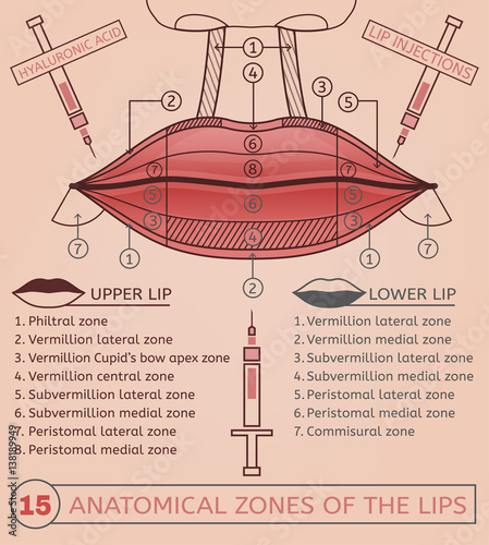 Lips Injections Image