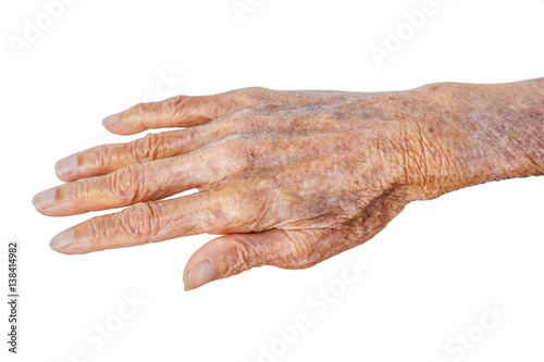 Old Asian female hands full of freckles and wrinkles at the age of more than 80 years old / Aging concept