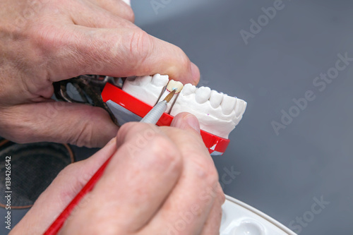 Dentist hands with brush working on ceramic dental model. photo