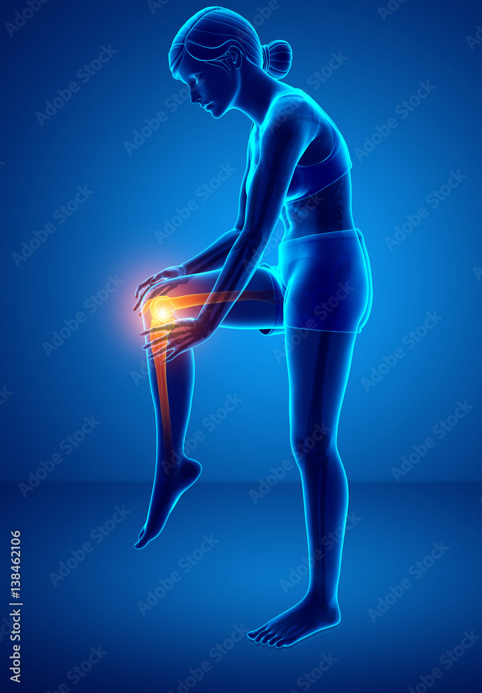 Women Knee joint pain