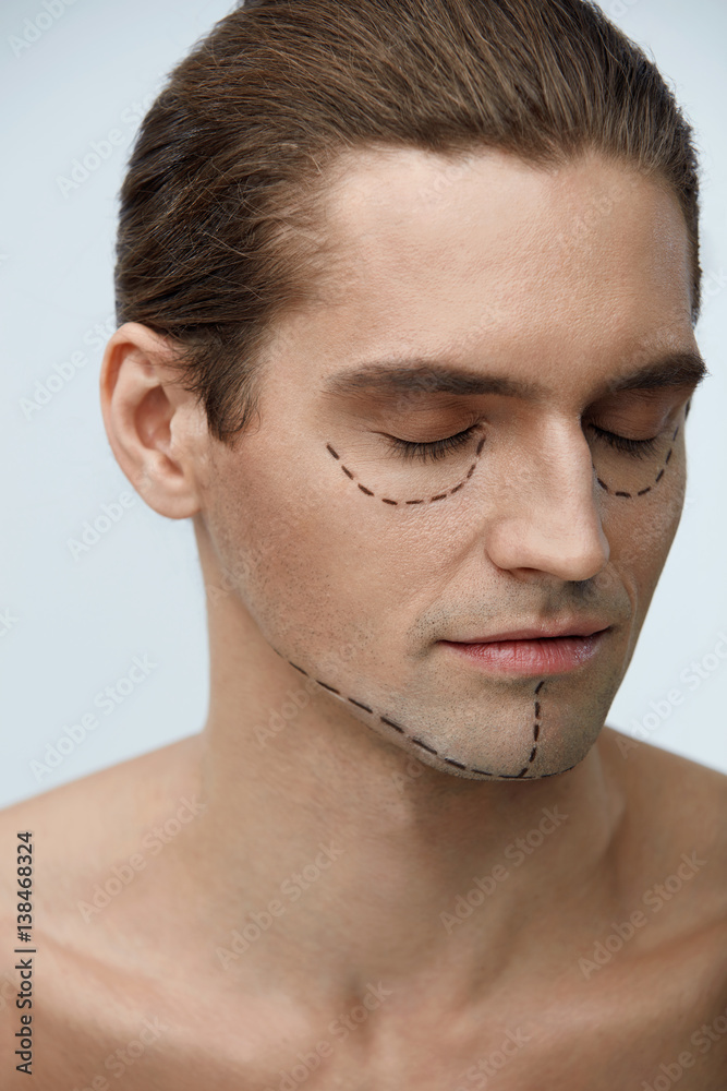 Obraz premium Plastic Surgery. Portrait Of Handsome Man With Lines On Face