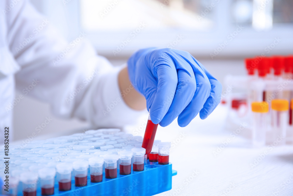 Woman working with blood samples in laboratory, closeup