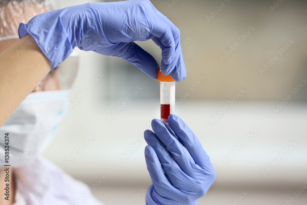 Obraz premium Medical professional in blue gloves holding blood sample vial for laboratory testing and diagnosis, this action is crucial for accurate diagnosis, disease monitoring