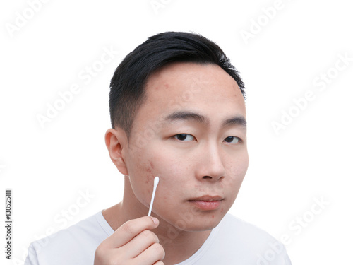 Young Asian man with proble...