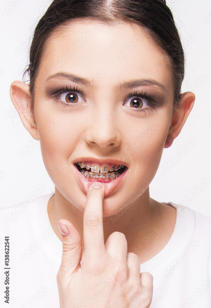 teen girl with brace smiling on white teen girl with brace smiling on white