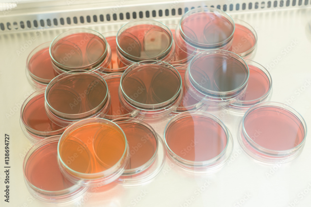 Eosin Methylene Blue (EMB) Agar for culture medium for Inoculum tests in Biological safety cabinets lab. Eosin Methylene Blue (EMB) Agar for culture medium for Inoculum tests in Biological safety cabinets lab.