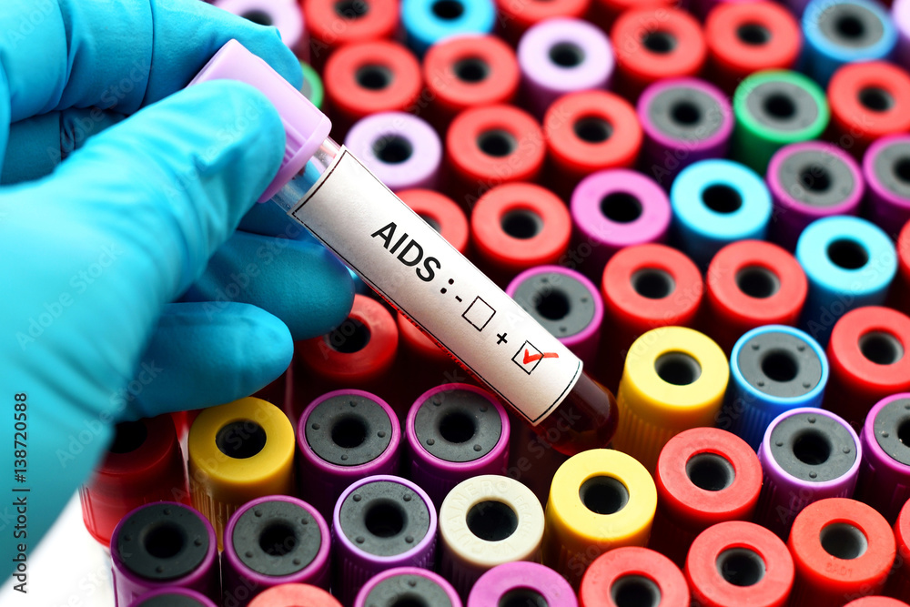 Naklejka premium AIDS positive