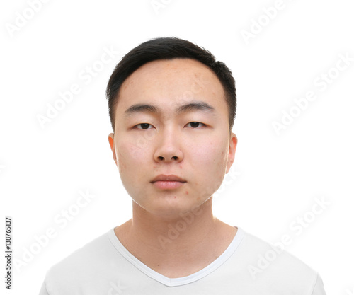 Young Asian man with proble...
