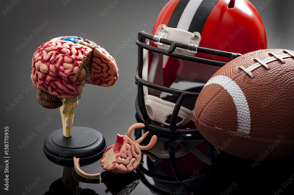 Brain damage and sports injury concept with damaged brain model, american football helmet and a ball, illustrating CTE (Chronic traumatic encephalopathy) a syndrome caused by repeated concussion