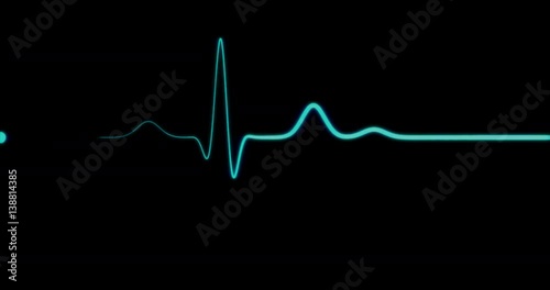 EKG Line / EKG Monitor / EKG Machine / Heart Health. Blue ECG monitor shows the heart beat. The heart stops for three seconds and starts again.
