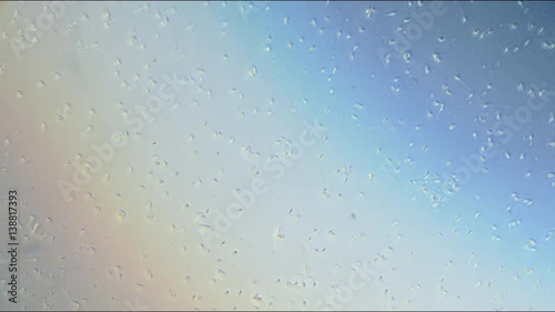 Healthy human sperm microscope with no polarization filter photo