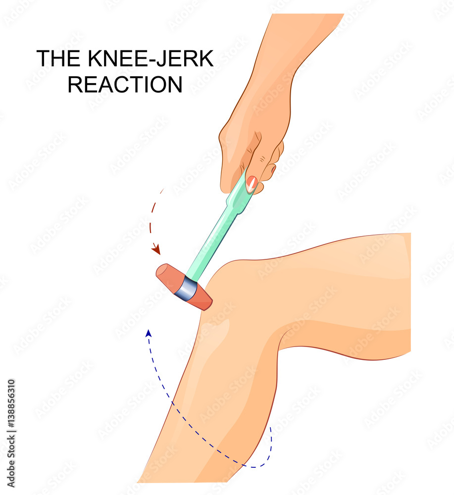Knee Jerk Reactions