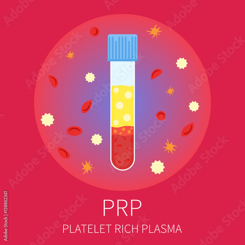 Test tubing filled with blood for PRP procedure on red background. Platelet rich plasma laboratory equipment. Medical concept. Vector illustration.

