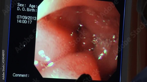 Endoscopy diagnose monitor photo