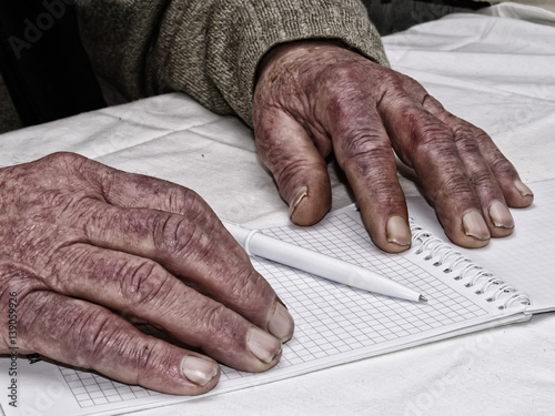 фотографія Closeup of the wrinkled hands of an old caucasian man holding pen and paper, wea