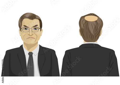front and back view of sad mature businessman with bald problem