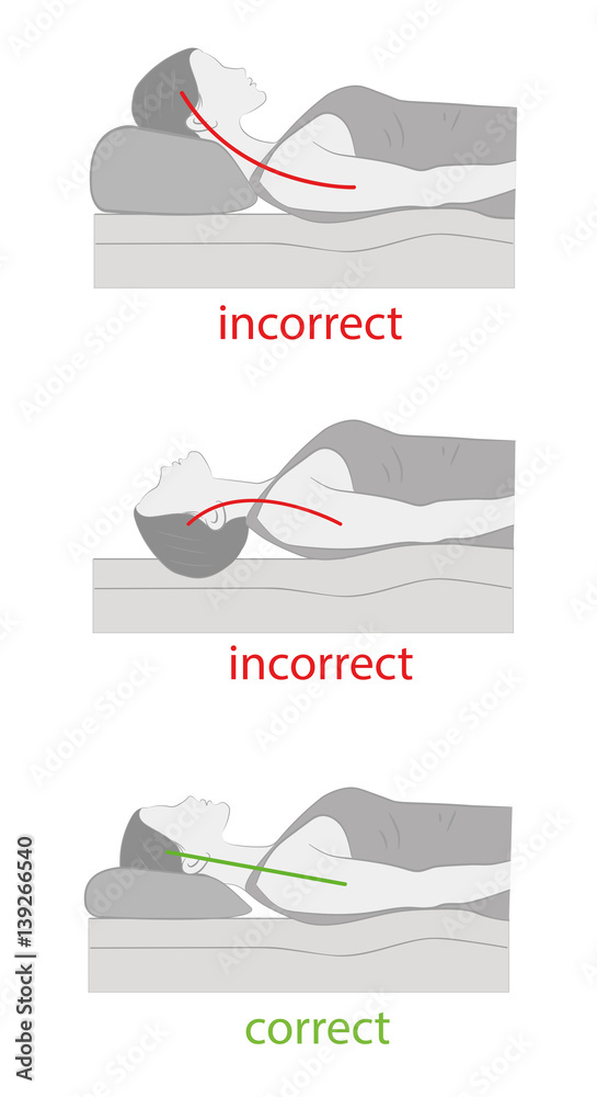 correct and incorrect position of the head on the pillow. medical ...