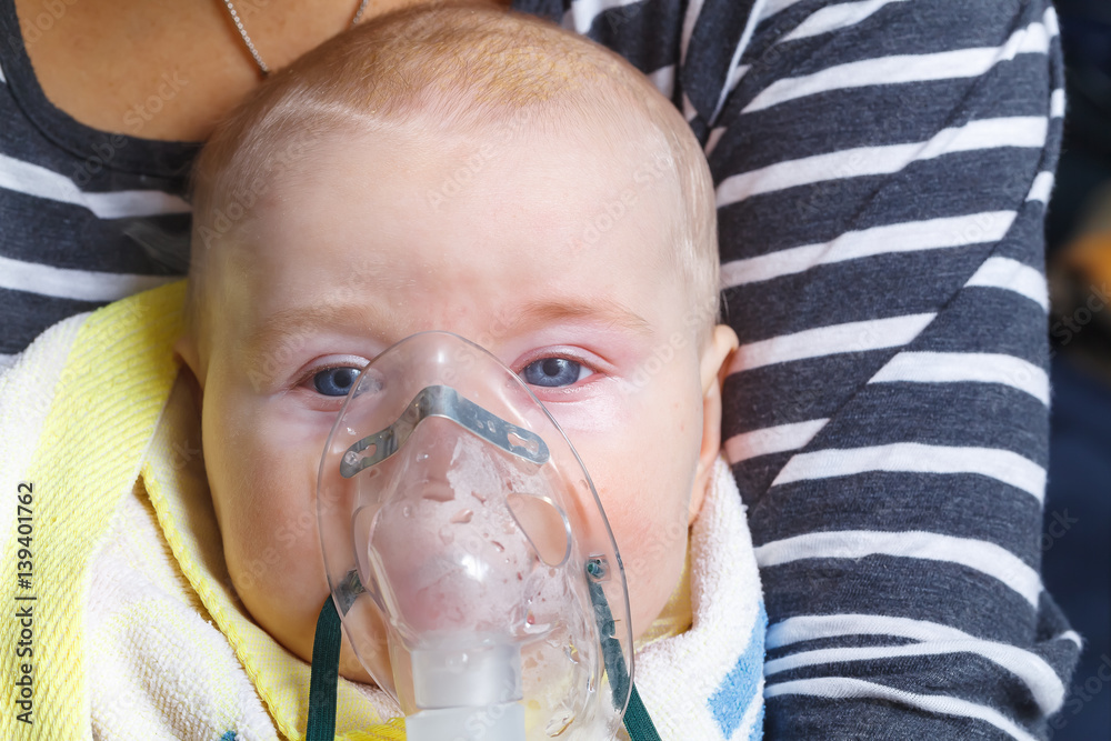 Inhalation child infant under one year