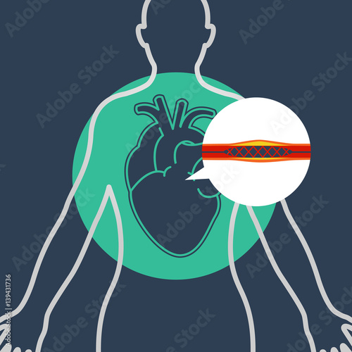 cardiac catheterization vector logo icon design