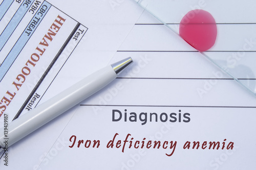 Diagnosis Iron deficiency anemia. Written by doctor hematological diagnosis Iron deficiency anemia in medical report, which are result of blood test and glass slide with blood smear for lab research