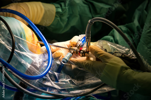 Orthopedic surgeons performing knee arthroscopic, keyhole surgery after serious injury.