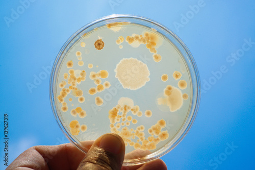 Colony of bacteria in culture medium plate photo