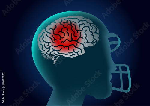 Silhouette Brain of American football player have a red signal. Illustration about injury of athlete.