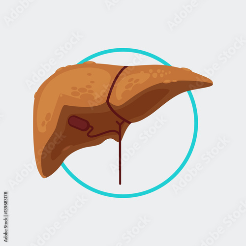 cirrhosis liver illustration