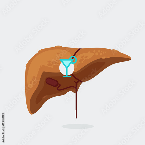 liver cirrhosis vector illustration
