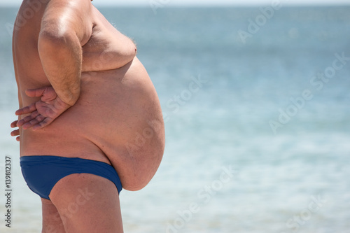 Side view of obese guy. Overweight man outdoor. Poor nutrition and sedentary lifestyle. Increased risk of heart illnesses. photo