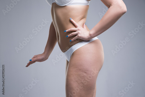 Woman in white underwear on gray background, cellulite on female body photo