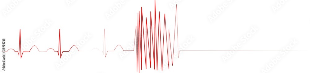 EKG mit Herz - obrazy, fototapety, plakaty 